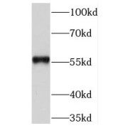 WB analysis of SH-SY5Y cells, using NEK3 antibody (1/300 dilution).