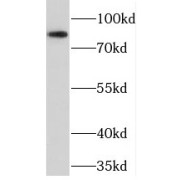 WB analysis of mouse pancreas tissue, using NELL1 antibody (1/500 dilution).