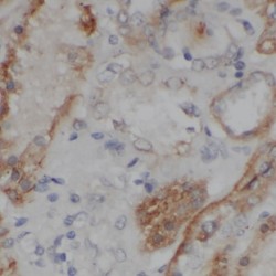 Protein Kinase C-Binding Protein NELL2 (NELL2) Antibody