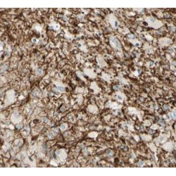 Nestin (NES) Antibody