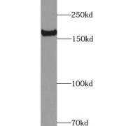 WB analysis of HEK-293 cells, using NES antibody (1/1000 dilution).
