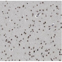Neurochondrin (NCDN) Antibody
