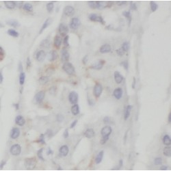Neurogenic Differentiation Factor 1 (NEUROD1) Antibody