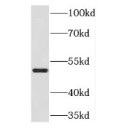 WB analysis of Y79 cells, using NEUROD1 antibody (1/200 dilution).