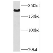 WB analysis of mouse brain tissue, using NAV1 antibody (1/500 dilution).