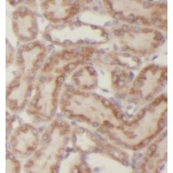 Neuropilin 1 (NRP1) Antibody