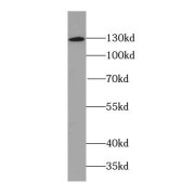 WB analysis of human brain tissue, using Neuropilin 1 antibody (1/2000 dilution).