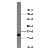 WB analysis of A431 cells, using NTF4 antibody (1/300 dilution).