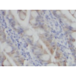 neurturin-Specific Antibody