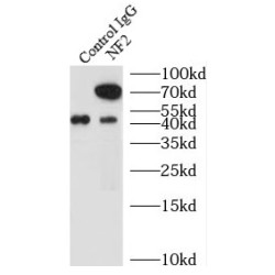 Neurofibromin 2 (NF2) Antibody