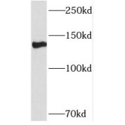 WB analysis of Jurkat cells, using NFATC2 antibody (1/1000 dilution).
