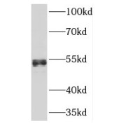 WB analysis of human heart tissue, using NFIB antibody (1/500).