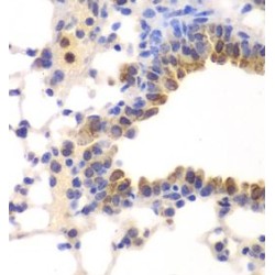 Nuclear Factor NF-Kappa-B P105 Subunit (NFKB1) Antibody