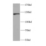 WB analysis of SH-SY5Y cells, using NFKB1 antibody (1/1000 dilution).