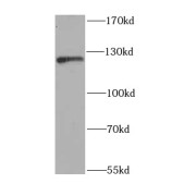 WB analysis of SH-SY5Y cells, using NFKB1 antibody (1/1000 dilution).