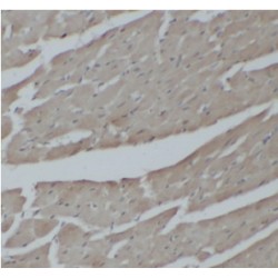 NF-Kappa-B Inhibitor Zeta (NFKBIZ) Antibody