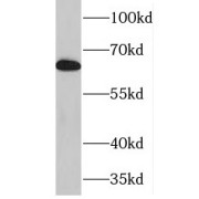 WB analysis of HeLa cells, using NFKBIZ antibody (1/600 dilution).