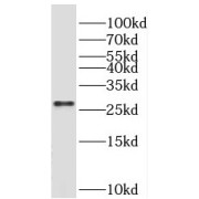 WB analysis of mouse liver tissue, using NGFRAP1 antibody (1/400 dilution).