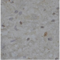 Small Nuclear Ribonucleoprotein 13 (NHP2L1) Antibody