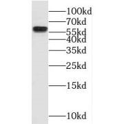 WB analysis of mouse kidney tissue, using NKD2 antibody (1/400 dilution).