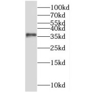 WB analysis of human testis tissue, using NKX3-1 antibody (1/800 dilution).