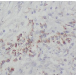 RNA-Binding Protein NOB1 (NOB1) Antibody