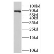 WB analysis of mouse brain tissue, using NOL4 antibody (1/800 dilution).
