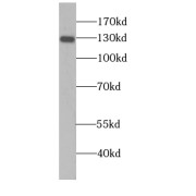 WB analysis of BxPC-3 cells, using NOMO2 antibody (1/300 dilution).