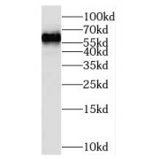 WB analysis of NIH/3T3 cells, using NOP56 antibody (1/1000 dilution).