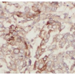 Neurogenic Locus Notch Homolog Protein 3 (NOTCH3) Antibody
