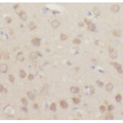 NADPH Oxidase 2 (NOX2) Antibody