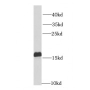 WB analysis of mouse heart tissue, using NPC2 antibody (1/1000 dilution).
