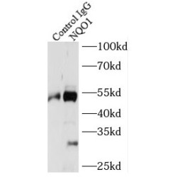 NAD(P)H Dehydrogenase, Quinone 1 (NQO1) Antibody