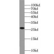 WB analysis of HeLa cells, using NQO2 antibody (1/1000 dilution).
