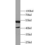 WB analysis of human liver tissue, using NR1H2 antibody (1/500 dilution).