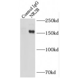 Glutamate Receptor Ionotropic, NMDA 2B (GRIN2B) Antibody