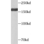 WB analysis of mouse brain tissue, using GRIN2B antibody (1/5000 dilution).
