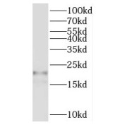 WB analysis of HEK-293 cells, using NRAS antibody (1/1500 dilution).