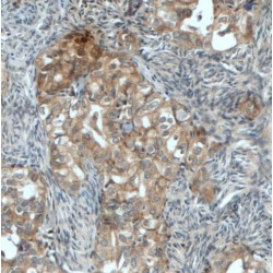 Nuclear Factor Erythroid 2-Related Factor 2 (NRF2) Antibody