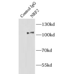Nuclear Factor Erythroid 2-Related Factor 2 (NRF2) Antibody