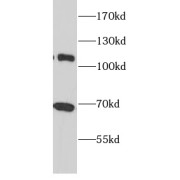 WB analysis of DMSO treated HeLa cells, using NRF2, NFE2L2 antibody (1/600 dilution).