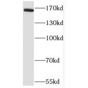 WB analysis of SH-SY5Y cells, using NRXN1 antibody (1/500 dilution).