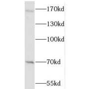 WB analysis of HeLa cells, using WHSC1L1 antibody (1/600 dilution).