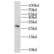 WB analysis of HeLa cells, using NSMCE2 antibody (1/500 dilution).