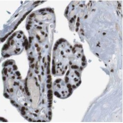 28S rRNA (Cytosine-C(5))-Methyltransferase (NSUN5) Antibody