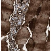 IHC-P analysis of human skeletal muscle tissue, using NT5C Antibody (1/50 dilution).