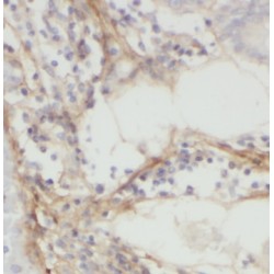 5'-Nucleotidase, Cytosolic III (NT5C3) Antibody