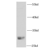 WB analysis of human placenta tissue, using NTF3 antibody (1/1000 dilution).
