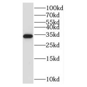 WB analysis of mouse colon tissue, using NUBPL antibody (1/1000 dilution).