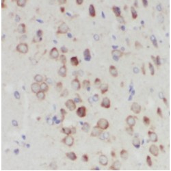 NudC Domain Containing 3 (NUDCD3) Antibody